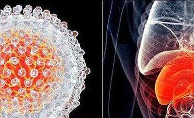 5 dấu hiệu dễ nhận biết của bệnh ung thư gan